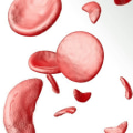 Difference Between Sickle Cell Anemia and Disease: Learn the Hidden Variants and How Each Impacts Diagnosis and Treatment