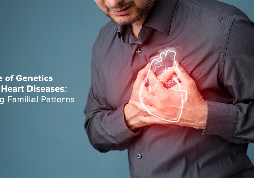 What Does CVD Stand For? Understanding the Meaning of Cardiovascular Disease and Its Impact on Your Health